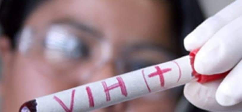 Preocupante aumento de VIH en jóvenes de Quintana Roo