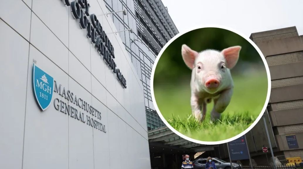 Trasplantan riñón de cerdo a paciente vivo por primera vez en EU